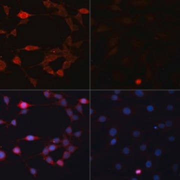 Anti-P70 S6K antibody produced in rabbit