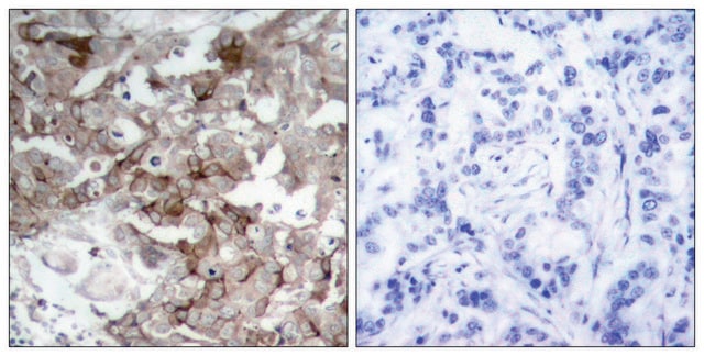 Anti-Cortactin antibody produced in rabbit affinity isolated antibody