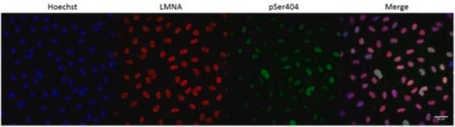 Anti-Phospho-Lamin A/C (Ser404) from rabbit