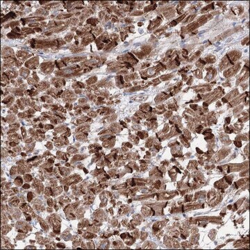 Anti-CDK5RAP2 antibody produced in rabbit Prestige Antibodies&#174; Powered by Atlas Antibodies, affinity isolated antibody, buffered aqueous glycerol solution