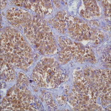 NSE (MRQ-55) Mouse Monoclonal Antibody