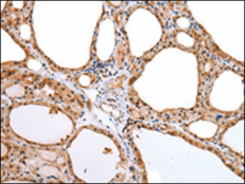 Anti-AQP9 affinity isolated antibody