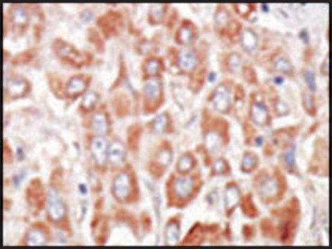 Anti-MSSK1 (center) antibody produced in rabbit IgG fraction of antiserum, buffered aqueous solution