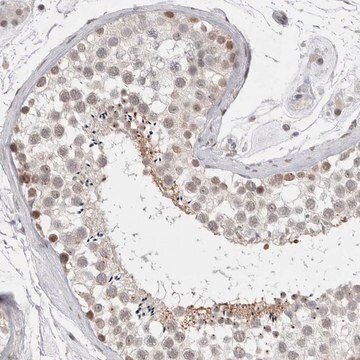 Anti-RECQL4 antibody produced in rabbit Prestige Antibodies&#174; Powered by Atlas Antibodies, affinity isolated antibody, buffered aqueous glycerol solution