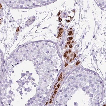 Anti-ZSCAN5A antibody produced in rabbit Prestige Antibodies&#174; Powered by Atlas Antibodies, affinity isolated antibody, buffered aqueous glycerol solution