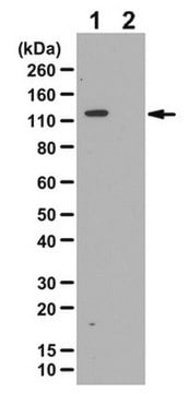 Anti-phospho-ULK1/ATG1 (Ser758) Antibody from rabbit, purified by affinity chromatography