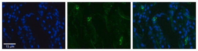 Anti-SLCO2B1 antibody produced in rabbit affinity isolated antibody