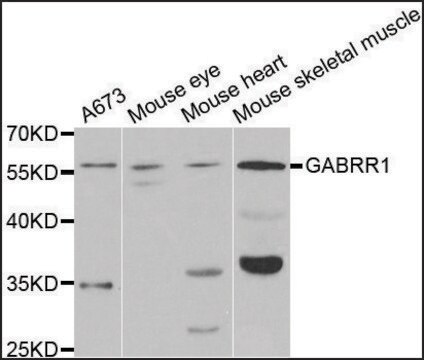 Anti-GABRR1 antibody produced in rabbit affinity isolated antibody