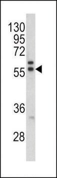 ANTI-MAPE(C-TERMINAL) antibody produced in rabbit purified immunoglobulin, buffered aqueous solution