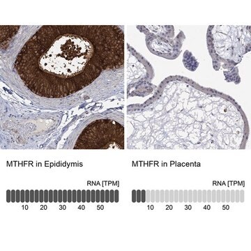 Anti-MTHFR antibody produced in rabbit Prestige Antibodies&#174; Powered by Atlas Antibodies, affinity isolated antibody, buffered aqueous glycerol solution