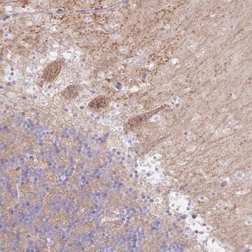 Anti-RASL10A antibody produced in rabbit Prestige Antibodies&#174; Powered by Atlas Antibodies, affinity isolated antibody, buffered aqueous glycerol solution