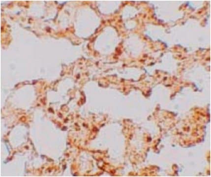 Anti-ZIP-6 Antibody from rabbit, purified by affinity chromatography