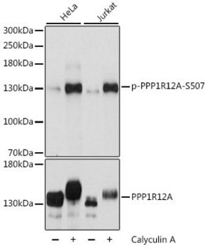 Anti-Phospho-PPP1R12A-S507 antibody produced in rabbit