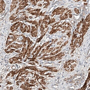 Anti-ARHGAP33 antibody produced in rabbit Prestige Antibodies&#174; Powered by Atlas Antibodies, affinity isolated antibody, buffered aqueous glycerol solution, ab1