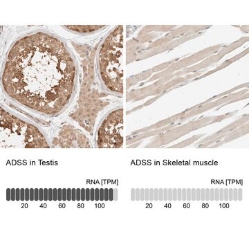 Anti-ADSS antibody produced in rabbit Prestige Antibodies&#174; Powered by Atlas Antibodies, affinity isolated antibody, buffered aqueous glycerol solution