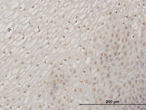 Monoclonal Anti-ERN1 antibody produced in mouse clone 3D1, purified immunoglobulin, buffered aqueous solution