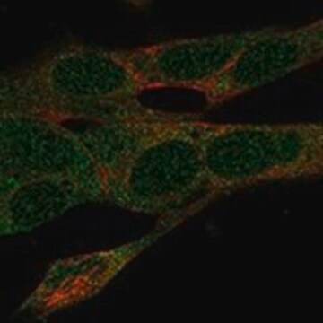 Anti-SDR39U1 antibody produced in rabbit Prestige Antibodies&#174; Powered by Atlas Antibodies, affinity isolated antibody, buffered aqueous glycerol solution