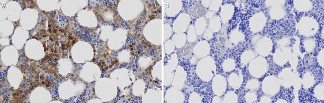 Anti-G6PD Antibody, clone 1F8 ZooMAb&#174; Rabbit Monoclonal recombinant, expressed in HEK 293 cells