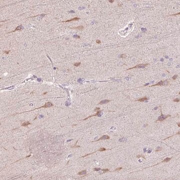 Anti-TMEM100 antibody produced in rabbit Prestige Antibodies&#174; Powered by Atlas Antibodies, affinity isolated antibody, buffered aqueous glycerol solution