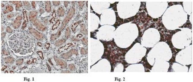 Anti-NLRP6 (NALP6) Antibody from rabbit, purified by affinity chromatography