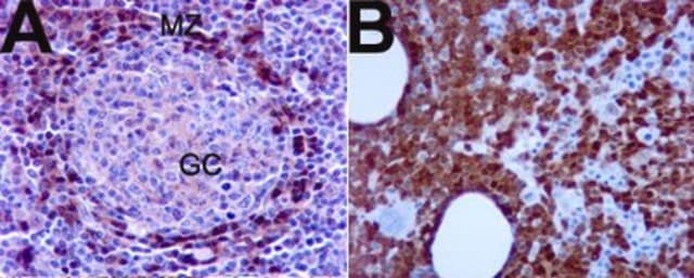 Anti-TCL1 Antibody culture supernatant, Upstate&#174;