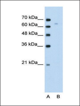 Anti-TOX antibody produced in rabbit affinity isolated antibody