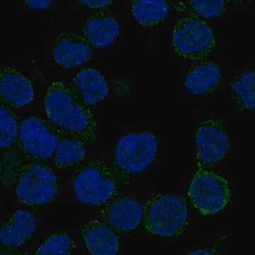 Anti-Ankrd30Bl Antibody Produced In Rabbit Prestige Antibodies&#174; Powered by Atlas Antibodies, affinity isolated antibody, buffered aqueous glycerol solution