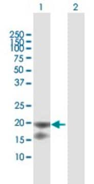 Anti-IL1RN antibody produced in mouse purified immunoglobulin, buffered aqueous solution