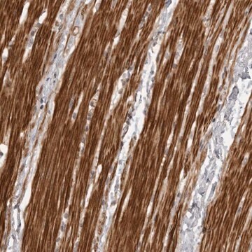 Anti-ZCCHC11 antibody produced in rabbit Prestige Antibodies&#174; Powered by Atlas Antibodies, affinity isolated antibody, buffered aqueous glycerol solution