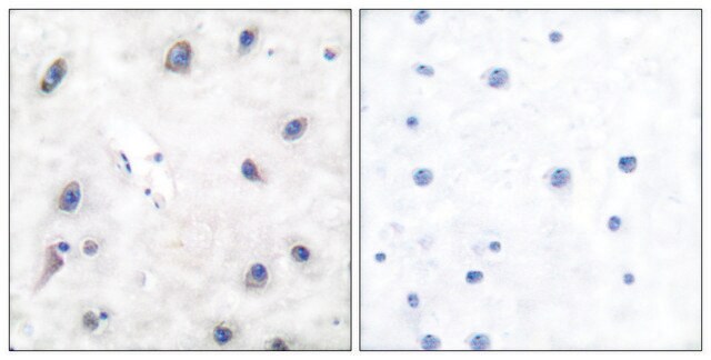 Anti-DARPP-32, N-Terminal antibody produced in rabbit affinity isolated antibody