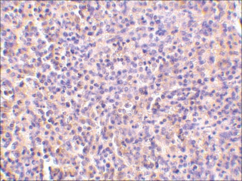 Anti-TCCR (ab2) antibody produced in rabbit affinity isolated antibody, buffered aqueous solution