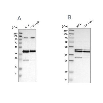 Anti-CFAP36 antibody produced in rabbit Prestige Antibodies&#174; Powered by Atlas Antibodies, affinity isolated antibody, buffered aqueous glycerol solution