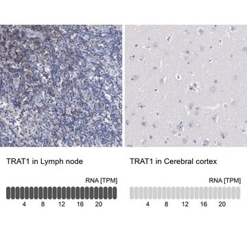 Anti-TRAT1 antibody produced in rabbit Prestige Antibodies&#174; Powered by Atlas Antibodies, affinity isolated antibody, buffered aqueous glycerol solution