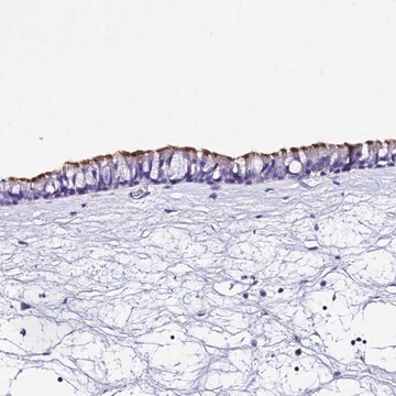 Anti-TMEM117 antibody produced in rabbit Prestige Antibodies&#174; Powered by Atlas Antibodies, affinity isolated antibody, buffered aqueous glycerol solution