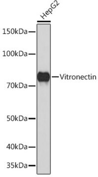 Anti-Vitronectin Antibody, clone 2V2V8, Rabbit Monoclonal