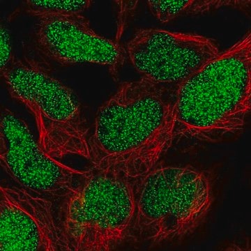 Anti-TM2D1 antibody produced in rabbit Prestige Antibodies&#174; Powered by Atlas Antibodies, affinity isolated antibody