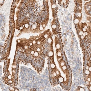 Anti-CYB5R4 antibody produced in rabbit Prestige Antibodies&#174; Powered by Atlas Antibodies, affinity isolated antibody, buffered aqueous glycerol solution