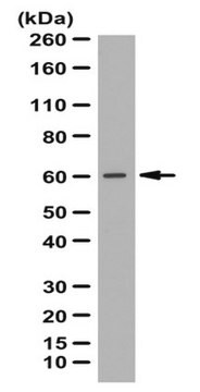 Anti-Abl interactor 1 Antibody from rabbit, purified by affinity chromatography