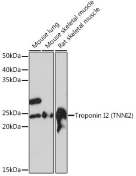 Anti-Troponin I2 (TNNI2) Antibody, clone 2H7S10, Rabbit Monoclonal