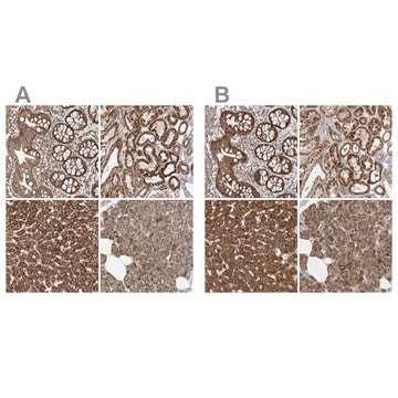 Anti-MUT antibody produced in rabbit Prestige Antibodies&#174; Powered by Atlas Antibodies, affinity isolated antibody, buffered aqueous glycerol solution