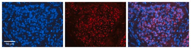 Anti-CPD antibody produced in rabbit affinity isolated antibody