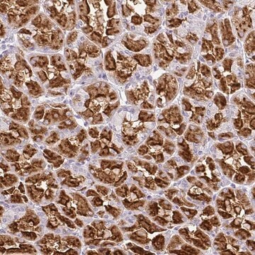 Anti-CMPK1 antibody produced in rabbit Prestige Antibodies&#174; Powered by Atlas Antibodies, affinity isolated antibody, buffered aqueous glycerol solution