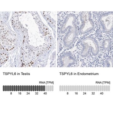 Anti-TSPYL6 antibody produced in rabbit Prestige Antibodies&#174; Powered by Atlas Antibodies, affinity isolated antibody, buffered aqueous glycerol solution