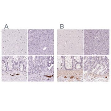 Anti-PRPH antibody produced in rabbit Prestige Antibodies&#174; Powered by Atlas Antibodies, affinity isolated antibody, buffered aqueous glycerol solution