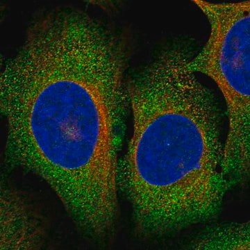 Anti-Mettl13 Antibody Produced In Rabbit Prestige Antibodies&#174; Powered by Atlas Antibodies, affinity isolated antibody, buffered aqueous glycerol solution