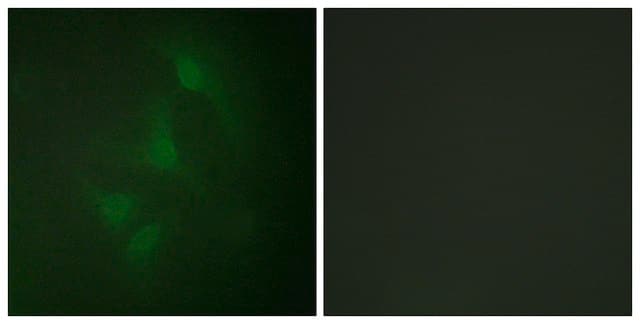 Anti-JNK1 antibody produced in rabbit affinity isolated antibody