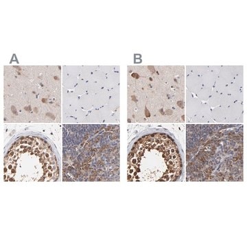 Anti-CCT2 antibody produced in rabbit Ab1, Prestige Antibodies&#174; Powered by Atlas Antibodies, affinity isolated antibody, buffered aqueous glycerol solution