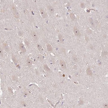 Anti-DIMT1 antibody produced in rabbit Prestige Antibodies&#174; Powered by Atlas Antibodies, affinity isolated antibody, buffered aqueous glycerol solution