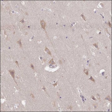 Anti-DLL3 antibody produced in rabbit Prestige Antibodies&#174; Powered by Atlas Antibodies, affinity isolated antibody, buffered aqueous glycerol solution