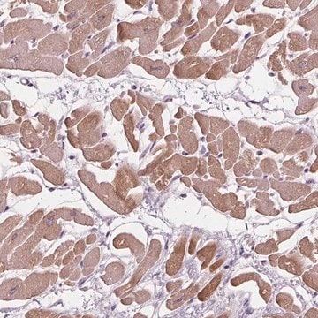 Anti-PLA2G2E antibody produced in rabbit Prestige Antibodies&#174; Powered by Atlas Antibodies, affinity isolated antibody, buffered aqueous glycerol solution